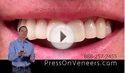 Press On Veneers All New Design